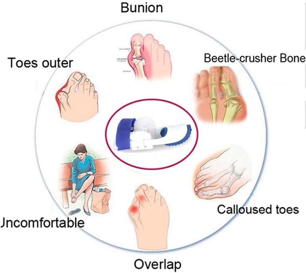 Foot Orthotic Bunion Splint Crooked  Thumb Corrector (1 Pair)