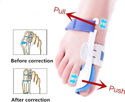 Foot Orthotic Bunion Splint Crooked  Thumb Corrector (1 Pair)